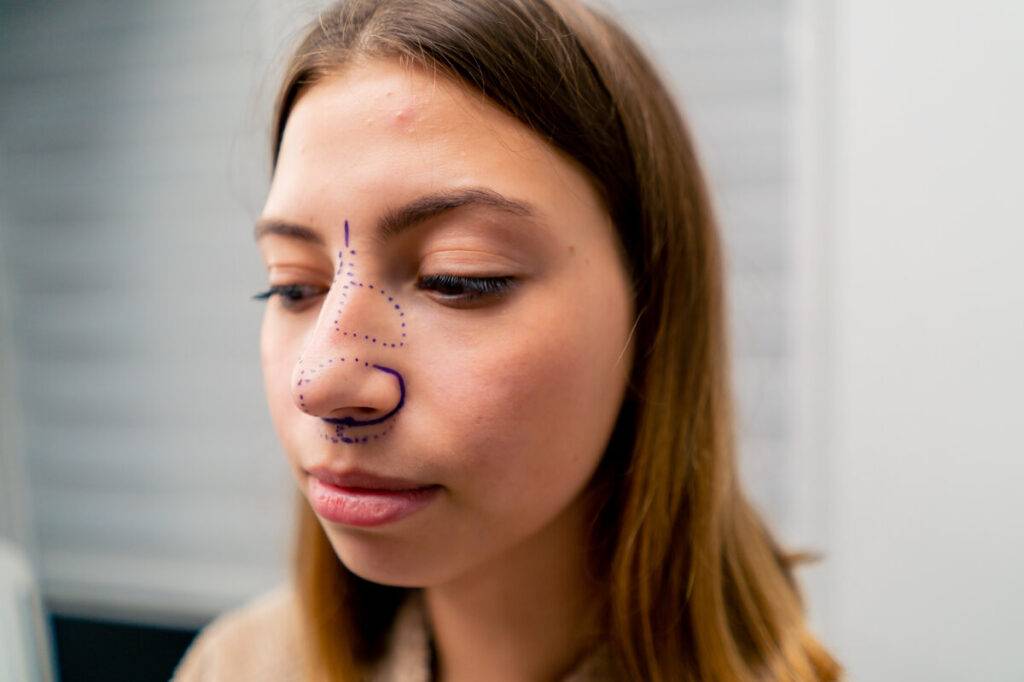 a woman with a dotted nose