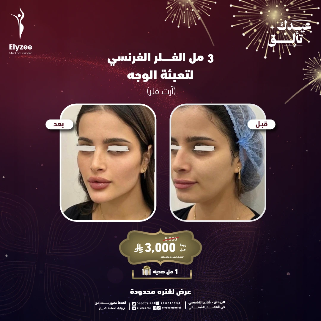 compressed-فلر-وجه