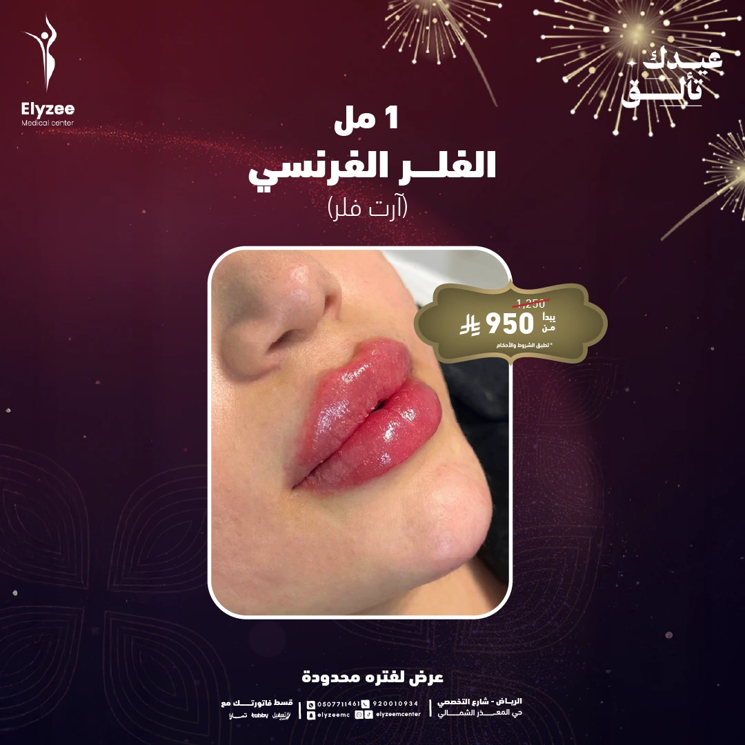 compressed-فلر