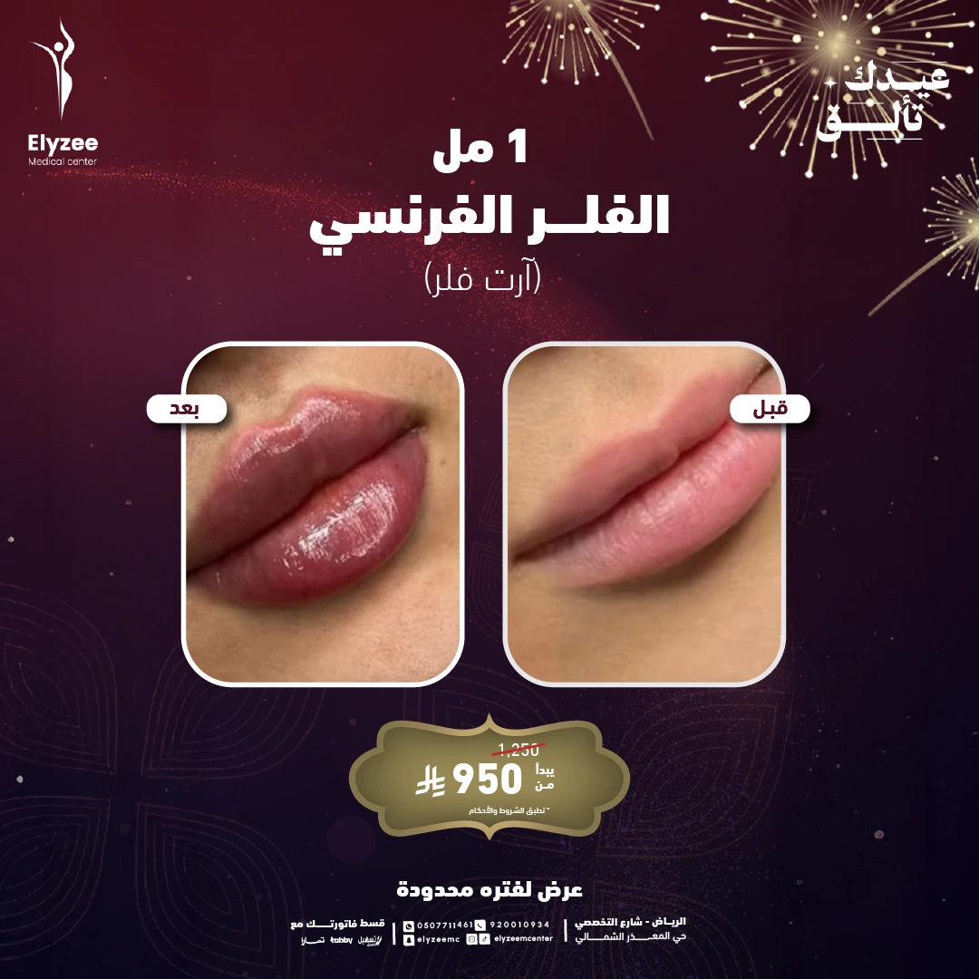 compressed-فلر_2